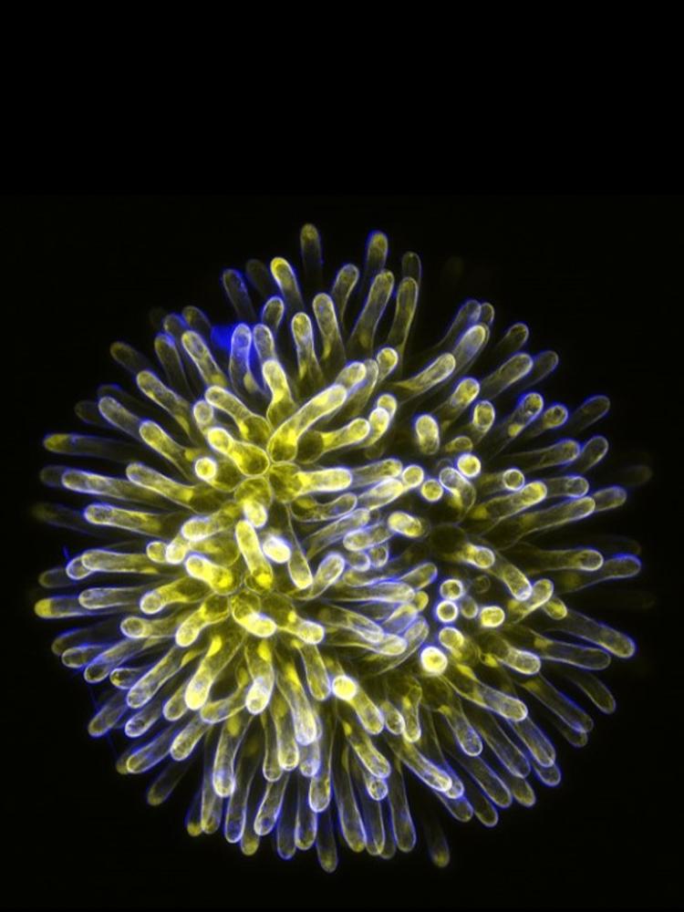 papillae
